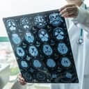 Doctor checking MRI scans to diagnose and treat brain issues